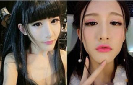 小灿整容前照片对比 被疑整容自称绝对不娘炮 小灿整容前照片对比 被疑整容自称绝对不娘炮