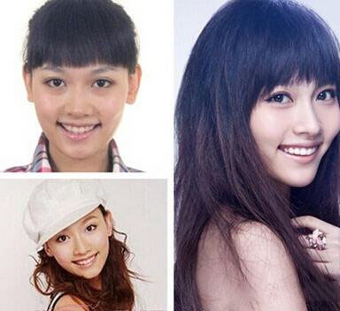 孙骁骁整容曝光 整容前后照吓坏前男友 孙骁骁整容曝光 整容前后照吓坏前男友