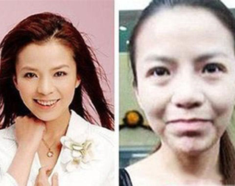 朱迅整容前后照片曝光 网曝其通过假体丰胸使胸部变大