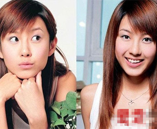 演员张子萱承认整容 旧照曝光样貌变化大