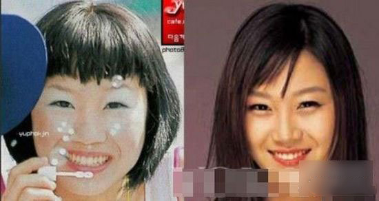 孔孝真整容了吗 孔孝真整容前后对比照曝光