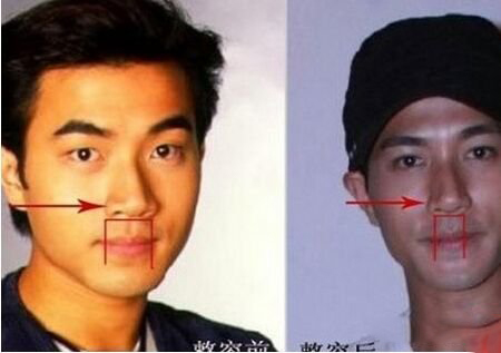 刘恺威整容变化大 粉丝抱怨TVB没眼光 刘恺威整容变化大 粉丝抱怨TVB没眼光