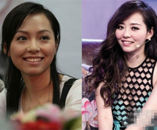 张靓颖整容前后对比 真人版的丑小鸭变天鹅 张靓颖整容前后对比 真人版的丑小鸭变天鹅