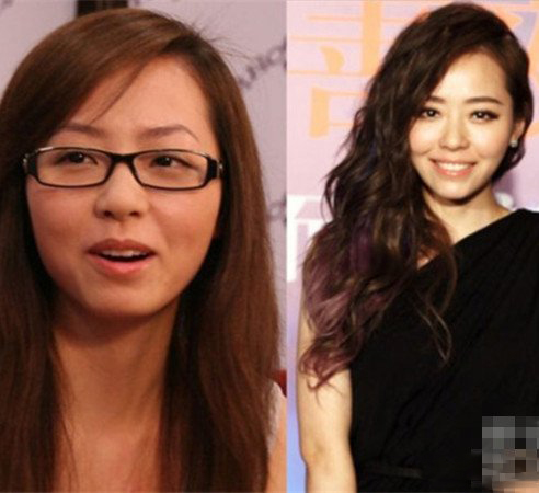 张靓颖整容前后对比 真人版的丑小鸭变天鹅 张靓颖整容前后对比 真人版的丑小鸭变天鹅