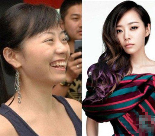 张靓颖整容前后对比 真人版的丑小鸭变天鹅 张靓颖整容前后对比 真人版的丑小鸭变天鹅