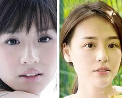 马思纯整容前图片疑曝光 盘点马思纯出道以来的照片 马思纯整容前图片疑曝光 盘点马思纯出道以来的照片