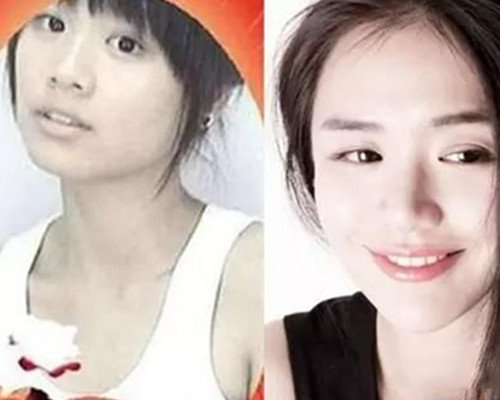 马思纯整容前图片疑曝光 盘点马思纯出道以来的照片 马思纯整容前图片疑曝光 盘点马思纯出道以来的照片