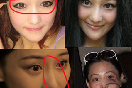 张馨予整容对比照大曝光 私生活混乱与吴卓羲床照流出 张馨予整容对比照大曝光 私生活混乱与吴卓羲床照流出