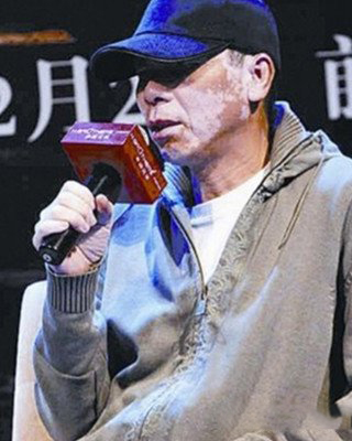 冯小刚白化病怎么好了 冯小刚白化病原因前后及近况