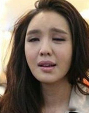 爆官恩娜面瘫照片 嘴歪眼斜极其吓人