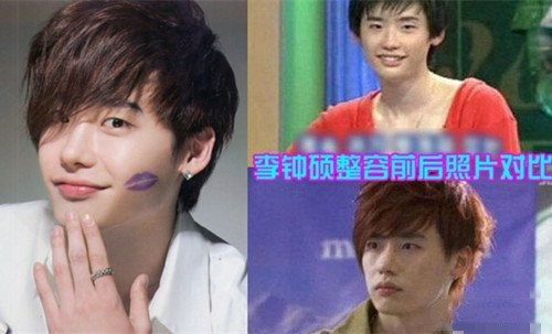 李钟硕整容前后照片曝光 如今靠实力演技获高人气 李钟硕整容前后照片曝光 如今靠实力演技获高人气