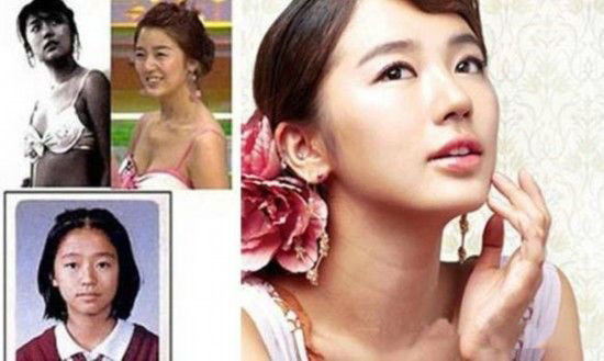 尹恩惠整容前后对比 尹恩惠个人资料介绍