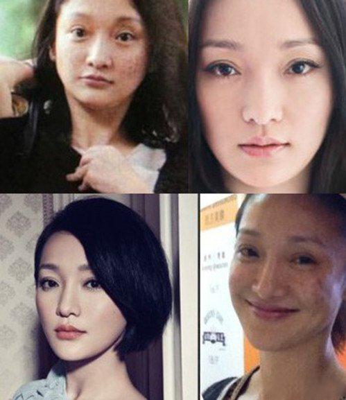 网称周迅吸毒烂脸 素颜照确实吓坏网友