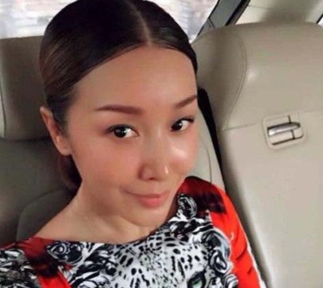 揭秘孙悦歌手近况 整容疑为破克夫相