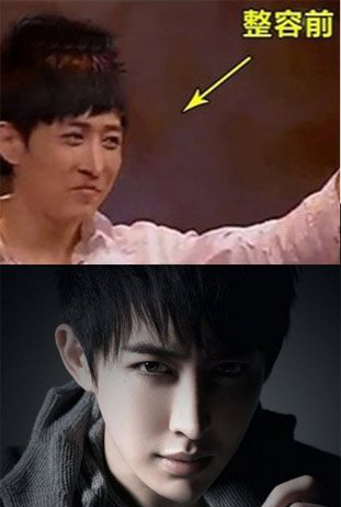 王亦丰整容了吗王亦丰yif整容前后对比照片