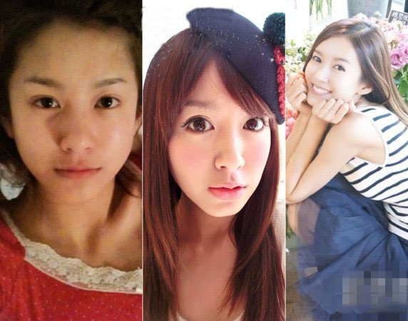 演员张子萱承认整容 旧照曝光样貌变化大